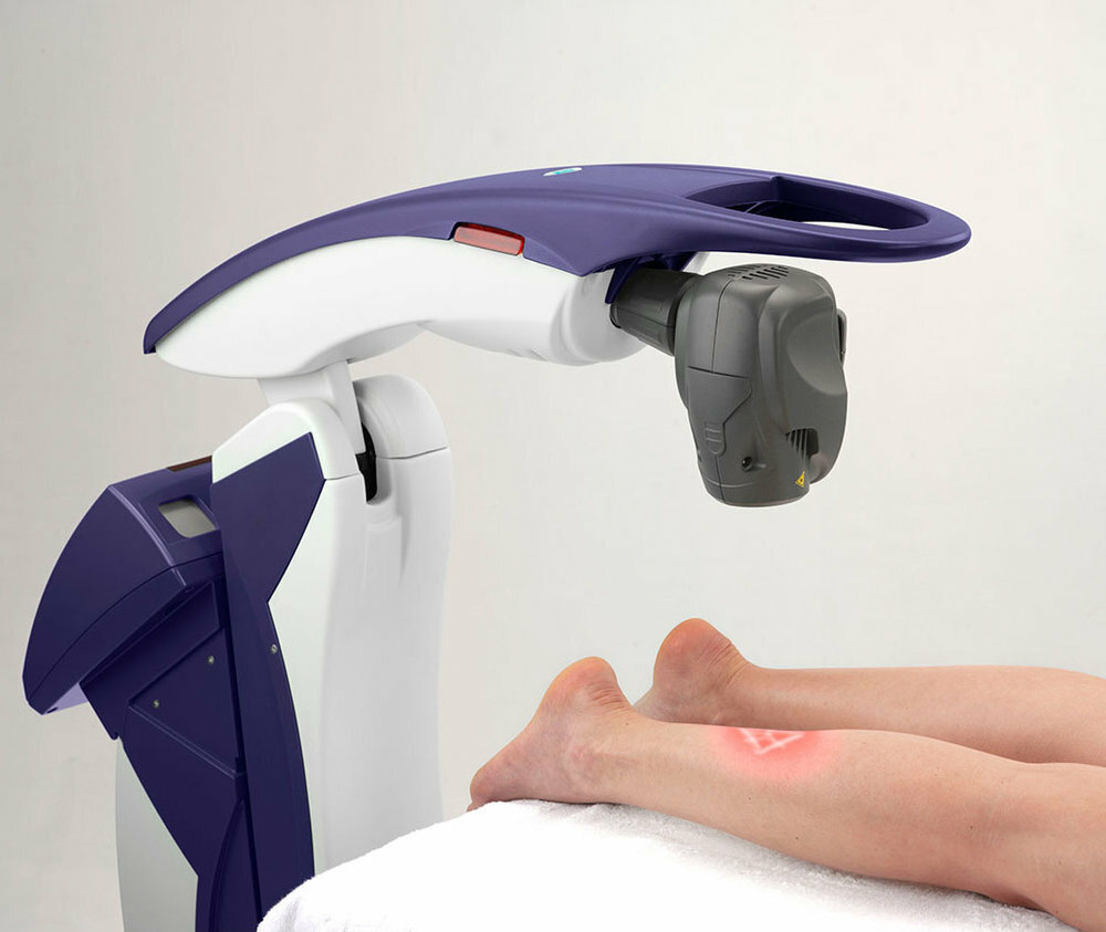 MLS Laser Therapy is a pain laser used for plantar fasciitis, achilles tendonitis, neuromas, neuropathies, arthritis diabetic foot ulcers tendon and ligament injuries, strained muscles and sprained ligaments.